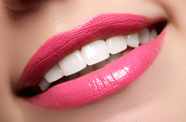 White teeth
