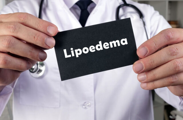 lipoedema