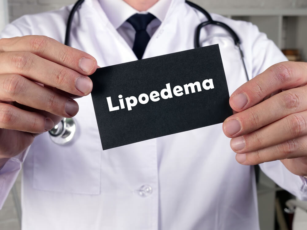 Lipodemia – co to takiego?